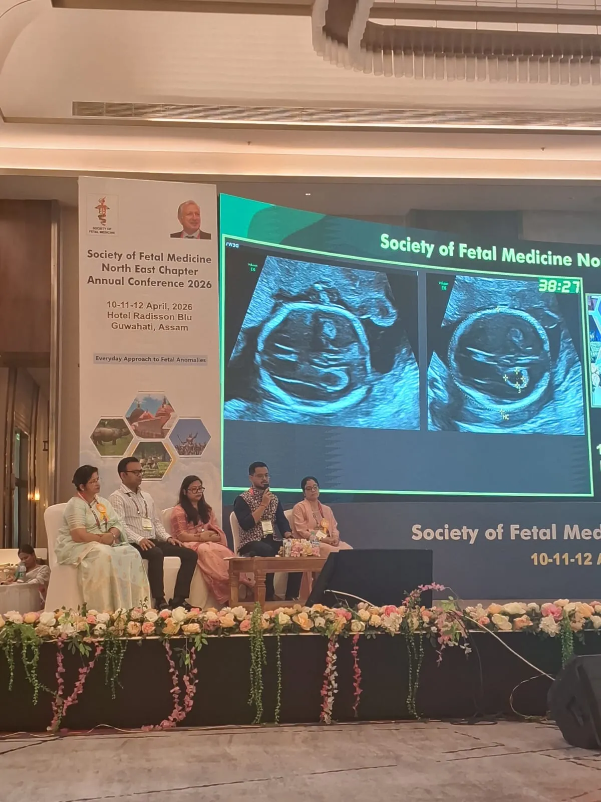 Ultrasound Scan 21